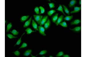 Immunofluorescence staining of A549 cells with ABIN7164376 at 1:166, counter-stained with DAPI. (DHX34 抗体  (AA 418-554))