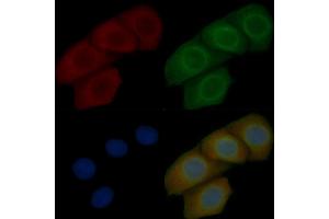 TOM40 Mouse Monoclonal Antibody staining Hela cells by IF/ICC. (TOMM40 抗体  (Internal Region))