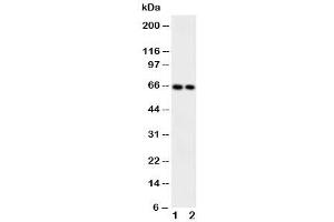 Western blot testing of CaMKK2 antibody and Lane 1:  rat brain (CAMKK2 抗体  (Middle Region))