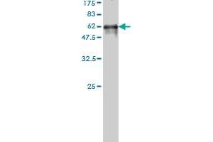 Western Blot detection against Immunogen (57. (PIH1D1 抗体  (AA 1-290))