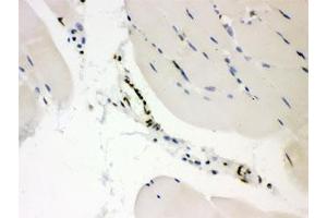 IHC testing of FFPE mouse skeletal muscle with CTBP2 antibody. (CTBP2 抗体  (AA 321-445))