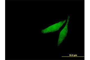 Immunofluorescence of purified MaxPab antibody to CAMK2G on HeLa cell. (CAMKII gamma 抗体  (AA 1-527))