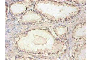 Immunohistochemical of paraffin-embedded human prostate tissue using ABIN7148973 at dilution of 1:200 (CST3 抗体)
