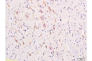 Formalin-fixed and paraffin embedded rat brain tissue labeled with Anti-DRD1 Polyclonal Antibody, Unconjugated  at 1:300, followed by conjugation to the secondary antibody and DAB staining (Dopamine Receptor d1 抗体  (AA 101-200))
