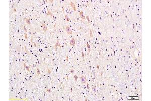 Formalin-fixed and paraffin embedded rat brain tissue labeled with Anti-DRD1 Polyclonal Antibody, Unconjugated  at 1:300, followed by conjugation to the secondary antibody and DAB staining