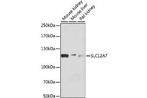 Western blot analysis of extracts of various cell lines, using SLC12A7 antibody. (SLC12A7 抗体)