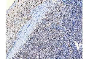 IHC analysis of HnRNP H/HNRNPH1 using anti-HnRNP H/HNRNPH1 antibody (ABIN4886623). (HNRNPH1 抗体  (N-Term))