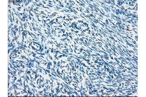 Immunohistochemical staining of paraffin-embedded colon tissue using anti-SORDmouse monoclonal antibody. (SORD 抗体)