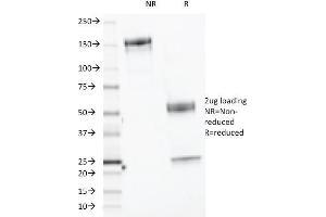 SDS-PAGE Analysis Purified CELA3B Monoclonal Antibody (CELA3B/1218). (Elastase 3B 抗体  (AA 82-238))
