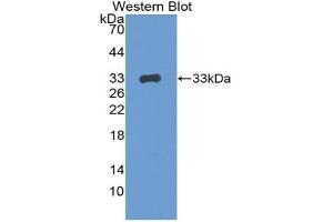 Detection of Recombinant BRCA1, Mouse using Polyclonal Antibody to Breast Cancer Susceptibility Protein 1 (BRCA1) (BRCA1 抗体  (AA 1524-1781))