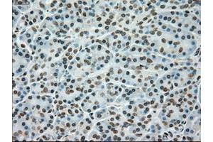 Image no. 9 for anti-TYRO3 Protein Tyrosine Kinase (TYRO3) antibody (ABIN1501608)