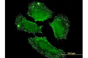 Immunofluorescence of monoclonal antibody to SH2D3C on HeLa cell. (SH2D3C 抗体  (AA 1-110))