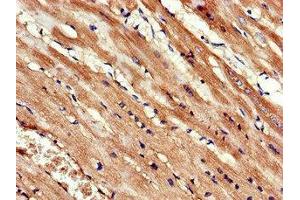 Immunohistochemistry of paraffin-embedded human heart tissue using ABIN7157595 at dilution of 1:100 (KIF14 抗体  (AA 261-531))