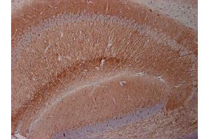 Immunohistochemistry (Paraffin-embedded Sections) (IHC (p)) image for anti-Microtubule-Associated Protein 2 (MAP2) (AA 2-309) antibody (ABIN1742387)