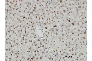 Immunoperoxidase of monoclonal antibody to HDAC1 on formalin-fixed paraffin-embedded human liver. (HDAC1 抗体  (AA 1-482))
