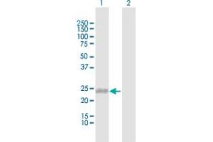 Western Blotting (WB) image for anti-Complement Component 1, Q Subcomponent, C Chain (C1QC) (AA 1-245) antibody (ABIN513856)
