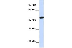 Western Blotting (WB) image for anti-KRR1, Small Subunit (SSU) Processome Component, Homolog (KRR1) antibody (ABIN2458524) (KRR1 抗体)