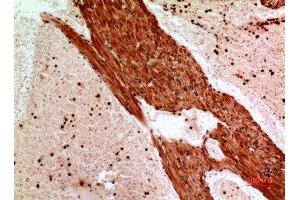 Immunohistochemistry (IHC) analysis of paraffin-embedded Mouse Heart, antibody was diluted at 1:100. (ANGPTL1 抗体  (Internal Region))