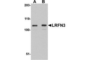 Western Blotting (WB) image for anti-Leucine Rich Repeat and Fibronectin Type III Domain Containing 3 (LRFN3) (Middle Region) antibody (ABIN1030988) (LRFN3 抗体  (Middle Region))