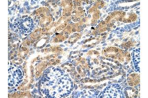 PTPN2 antibody was used for immunohistochemistry at a concentration of 4-8 ug/ml to stain EpitheliaI cells of renal tubule (arrows) in Human Kidney. (PTPN2 抗体  (Middle Region))
