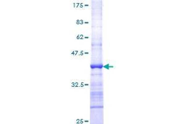 DMC1 Protein (AA 237-339) (GST tag)