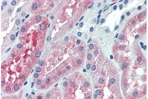 Human Kidney: Formalin-Fixed, Paraffin-Embedded (FFPE) (OCRL 抗体  (AA 146-240))