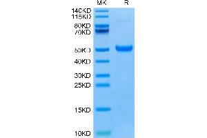 Human DKK1 C terminal Domain on Tris-Bis PAGE under reduced condition. (DKK1 Protein (AA 178-266) (Fc-Avi Tag))