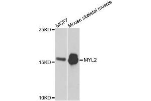 Western blot analysis of extracts of various cell lines, using MYL2 antibody. (MYL2 抗体  (AA 1-166))