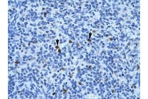 Annexin A3 antibody was used for immunohistochemistry at a concentration of 4-8 ug/ml to stain Spleen cells (arrows) in Human Spleen. (Annexin A3 抗体  (N-Term))