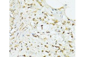 Immunohistochemistry of paraffin-embedded Human vermiform appendix using TRIM15 Polyclonal Antibody at dilution of 1:100 (40x lens). (TRIM15 抗体)
