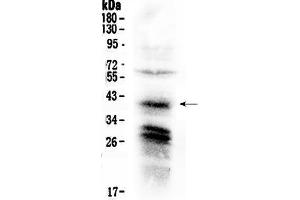 Western blot analysis of CXCR4 using anti-CXCR4 antibody . (CXCR4 抗体  (C-Term))
