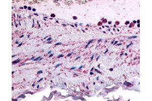 Immunohistochemical (Formalin/PFA-fixed paraffin-embedded sections) staining in human vascular smooth muscle with PTPMT1 polyclonal antibody . (PTPMT1 抗体)