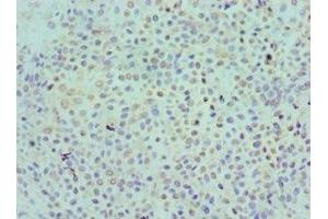 Immunohistochemistry (IHC) image for anti-Killer Cell Immunoglobulin-Like Receptor, Two Domains, Short Cytoplasmic Tail, 4 (KIR2DS4) (AA 22-245) antibody (ABIN7157519)