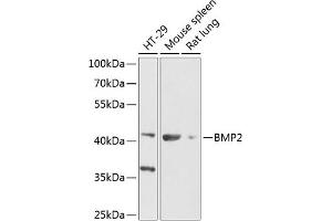 Western blot analysis of extracts of various cell lines, using BMP2 Antibody (ABIN6127494, ABIN6137595, ABIN6137596 and ABIN6216531) at 1:1000 dilution. (BMP2 抗体  (AA 1-100))