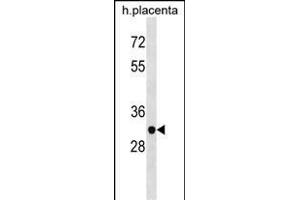 ZN Antibody (N-term) (ABIN1538903 and ABIN2838229) western blot analysis in human placenta tissue lysates (35 μg/lane). (ZNF783 抗体  (N-Term))