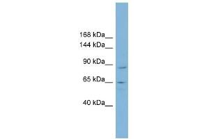 MGC16169 antibody used at 1 ug/ml to detect target protein. (TBCK 抗体  (Middle Region))