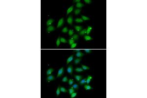 Immunofluorescence analysis of HeLa cells using PPP2CA antibody (ABIN5974047). (PPP2CA 抗体)