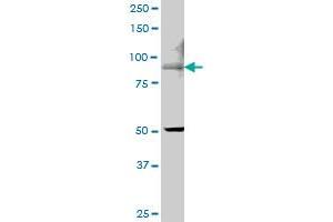 Western Blotting (WB) image for anti-Transient Receptor Potential Cation Channel, Subfamily V, Member 5 (TRPV5) (AA 1-100) antibody (ABIN527913)