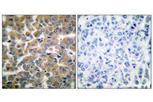 Immunohistochemistry (IHC) image for anti-GR (Internal Region), (pSer211) antibody (ABIN1847912) (GR (Internal Region), (pSer211) 抗体)