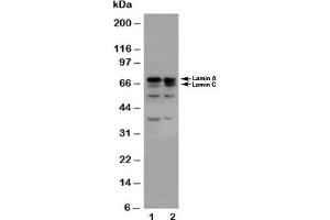 Western blot testing of Lamin A/C antibody and Lane 1:  HeLa;  2: A431 cell lysate (Lamin A/C 抗体  (AA 455-469))