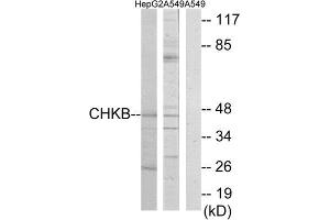 Western Blotting (WB) image for anti-Choline Kinase beta (CHKB) (C-Term) antibody (ABIN1850102) (CHKB 抗体  (C-Term))