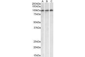 ABIN4902793 (0. (VPS16 抗体  (Isoform 1))