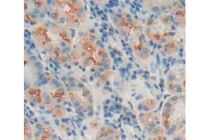 Used in DAB staining on fromalin fixed paraffin- embedded stomach tissue (MPP3 抗体  (AA 385-570))