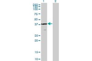 Western Blot analysis of VPS26A expression in transfected 293T cell line by VPS26A monoclonal antibody (M02), clone 1C4. (VPS26A 抗体  (AA 228-327))