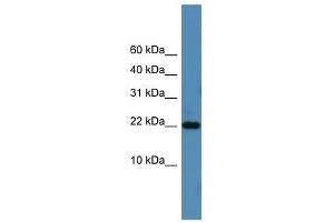 Western Blot showing SFRS12IP1 antibody used at a concentration of 1-2 ug/ml to detect its target protein. (SFRS12IP1 抗体  (N-Term))