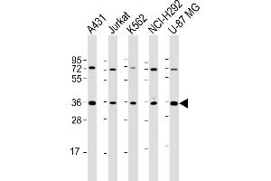 All lanes : Anti-ETV7 Antibody (C-term) at 1:2000 dilution Lane 1: A431 whole cell lysate Lane 2: Jurkat whole cell lysate Lane 3: K562 whole cell lysate Lane 4: NCI- whole cell lysate Lane 5: U-87 MG whole cell lysate Lysates/proteins at 20 μg per lane. (ETV7 抗体  (C-Term))
