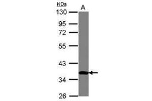 Image no. 1 for anti-Zinc Finger Protein 177 (ZNF177) (AA 113-301) antibody (ABIN1501828) (ZNF177 抗体  (AA 113-301))
