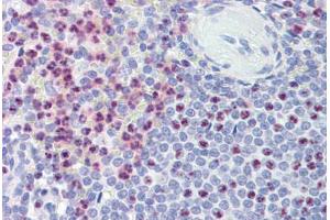 Spleen, Human: Formalin-Fixed, Paraffin-Embedded (FFPE) (PKD1 抗体  (AA 4289-4300))