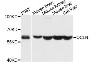 Western blot analysis of extracts of various cells, using OCLN antibody. (Occludin 抗体)