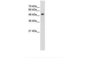 Image no. 2 for anti-Solute Carrier Family 1 Member 5 (SLC1A5) (AA 241-290) antibody (ABIN203414) (SLC1A5 抗体  (AA 241-290))
